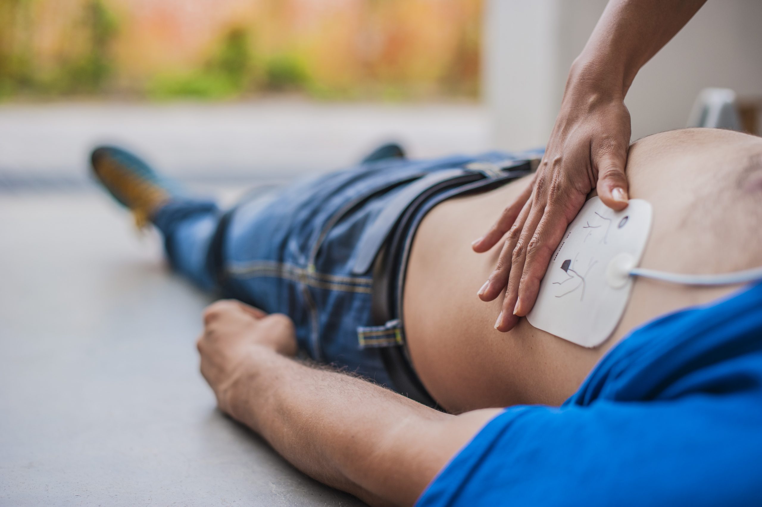Applicazione elettrodi defibrillatore